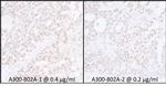 SUPT6H Antibody in Immunohistochemistry (IHC)