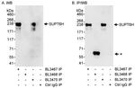 SUPT6H Antibody in Immunoprecipitation (IP)