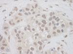 SUPT7L Antibody in Immunohistochemistry (IHC)