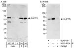 SUPT7L Antibody in Western Blot (WB)