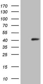 SYCP3 Antibody in Western Blot (WB)