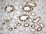 SYNE1 Antibody in Immunohistochemistry (Paraffin) (IHC (P))