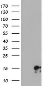 SYNJ2BP Antibody in Western Blot (WB)