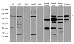 SYNPO Antibody in Western Blot (WB)