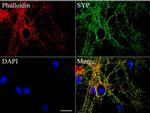 SYP Antibody in Immunocytochemistry (ICC/IF)