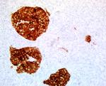 SYP Antibody in Immunohistochemistry (Paraffin) (IHC (P))