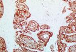 SYP Antibody in Immunohistochemistry (Paraffin) (IHC (P))