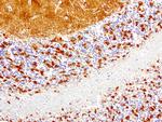 SYP Antibody in Immunohistochemistry (Paraffin) (IHC (P))