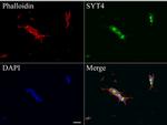 SYT4 Antibody in Immunocytochemistry (ICC/IF)