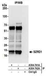 SZRD1 Antibody in Western Blot (WB)