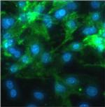 Sarcomeric alpha Actin Antibody in Immunocytochemistry (ICC/IF)