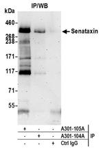 Senataxin Antibody in Western Blot (WB)