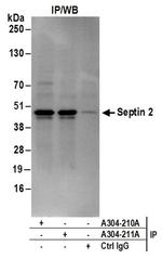 Septin 2 Antibody in Western Blot (WB)