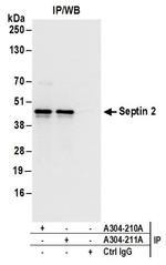 Septin 2 Antibody in Western Blot (WB)