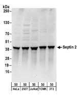 Septin 2 Antibody in Western Blot (WB)