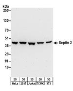 Septin 2 Antibody in Western Blot (WB)