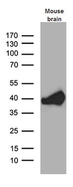 Septin 3 Antibody in Western Blot (WB)