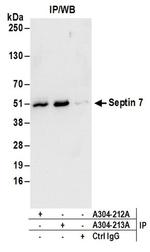 Septin 7 Antibody in Western Blot (WB)