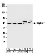 Septin 7 Antibody in Western Blot (WB)