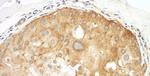 Septin 9 Antibody in Immunohistochemistry (IHC)