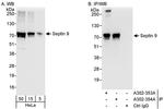 Septin 9 Antibody in Western Blot (WB)