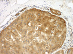 Septin 9 Antibody in Immunohistochemistry (IHC)