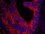 Septin 9 Antibody in Immunohistochemistry (IHC)