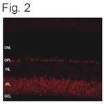 SHANK1 Antibody in Immunohistochemistry (IHC)