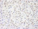 Sin3A Antibody in Immunohistochemistry (IHC)