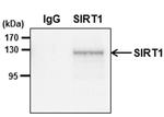 SIRT1 Antibody in Immunoprecipitation (IP)