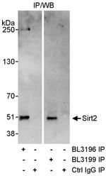 Sirt2 Antibody in Immunoprecipitation (IP)