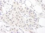 Sm-D3 Antibody in Immunohistochemistry (IHC)