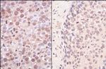 SmcHD1 Antibody in Immunohistochemistry (IHC)