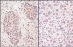 SmcHD1 Antibody in Immunohistochemistry (IHC)