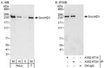 SmcHD1 Antibody in Western Blot (WB)