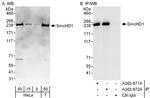 SmcHD1 Antibody in Western Blot (WB)