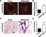 Alpha-Smooth Muscle Actin Antibody in Immunohistochemistry (IHC)