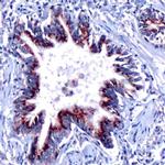 SHH Antibody in Immunohistochemistry (Paraffin) (IHC (P))