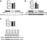 Sorcin Antibody in Western Blot (WB)