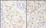 Sp1 Antibody in Immunohistochemistry (IHC)