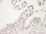 Sp1 Antibody in Immunohistochemistry (IHC)