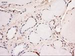 Stat5a Antibody in Immunohistochemistry (Paraffin) (IHC (P))