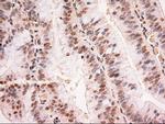 Stat5a Antibody in Immunohistochemistry (Paraffin) (IHC (P))