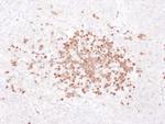 Stomatin Antibody in Immunohistochemistry (IHC)