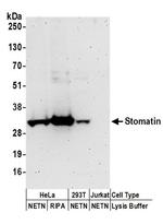 Stomatin Antibody in Western Blot (WB)