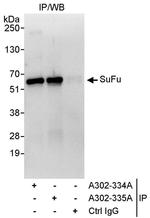 SuFu Antibody in Immunoprecipitation (IP)