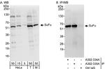 SuFu Antibody in Western Blot (WB)