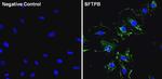 SFTPB Antibody in Immunocytochemistry (ICC/IF)