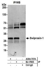 Swiprosin-1 Antibody in Immunoprecipitation (IP)