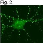 SynGAP Antibody in Immunocytochemistry (ICC/IF)